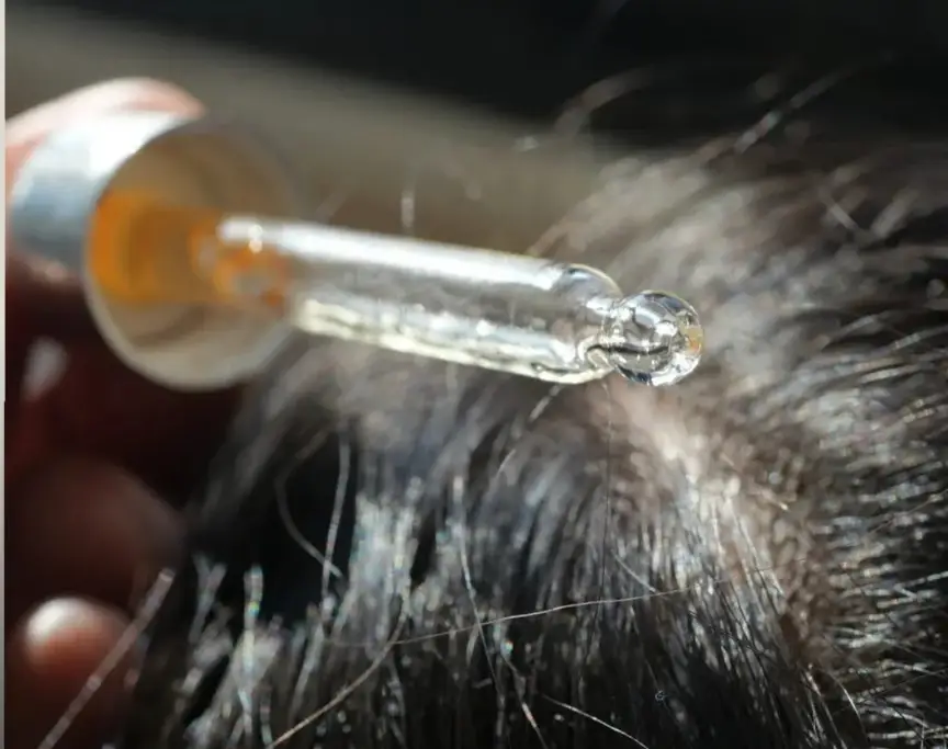 Amazon Hair Growth Products Recalled Over Child Poisoning Risk