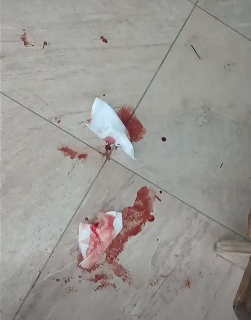 Mysterious Blood Trail Discovered Outside Antigua's Public Library